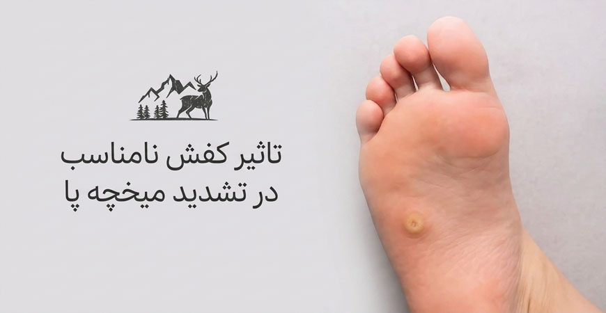 تاثیر کفش نامناسب در تشدید میخچه پا